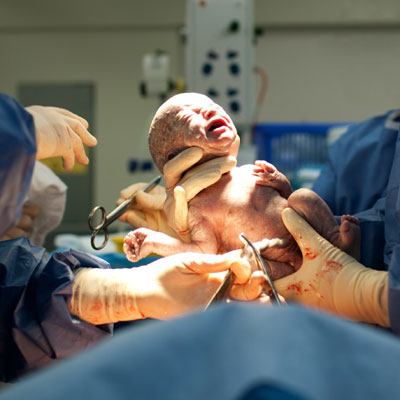 Cesarean Delivery in Jalandhar Punjab
